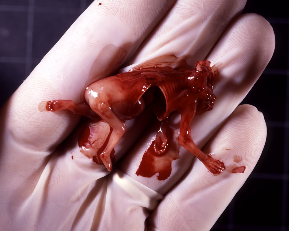Aborted at 11 Weeks