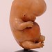 Whole Early Fetus