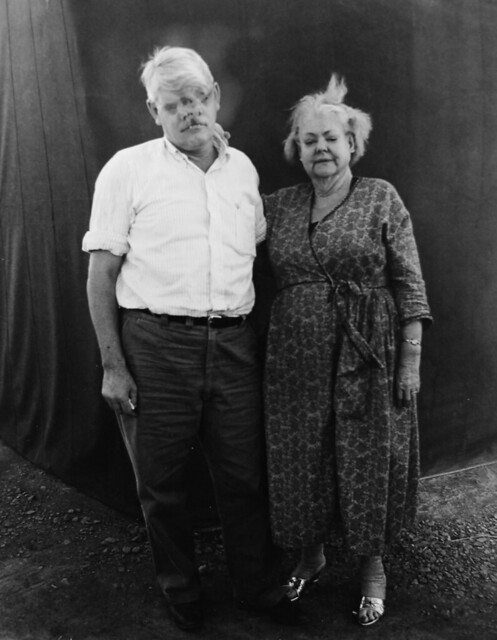 Diane Arbus portrait of Bill Durks, The Man with Three Eyes and Two Noses, and his wife Mildred, alligator-skinned girl