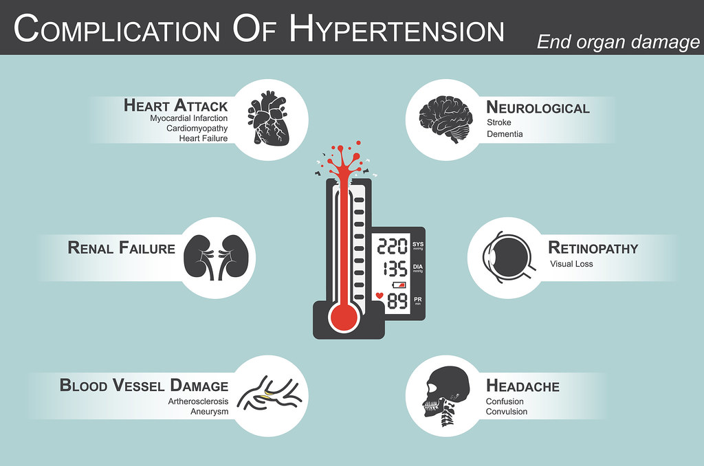 Complications of High Blood Pressure..