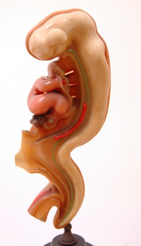 Embryo 4mm