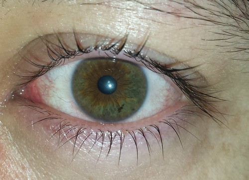 Eye Freckles | I like my freckle =) | Alejandro Matos | Flickr