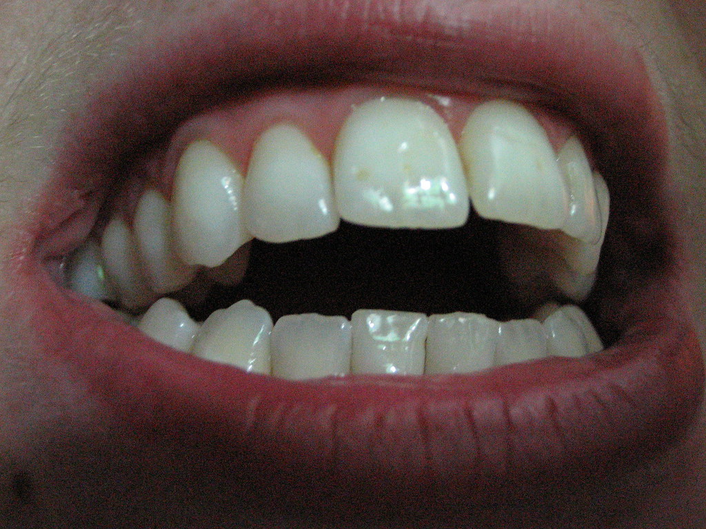 teeth