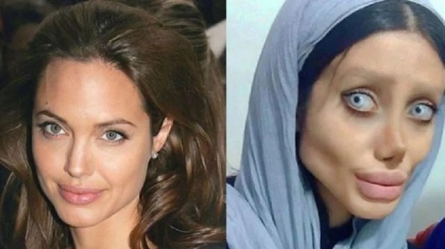 4002 This woman undergone 50 surgeries to look like Angelina Jolie 03