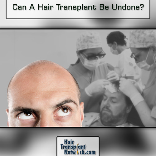 Hair Transplant network  Owner  Hair Transplant Network Group  LinkedIn