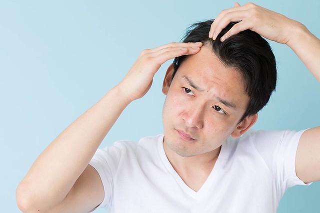 Hair Loss Treatment in Singapore (from a doctor’s viewpoint) - Ubiqi Health