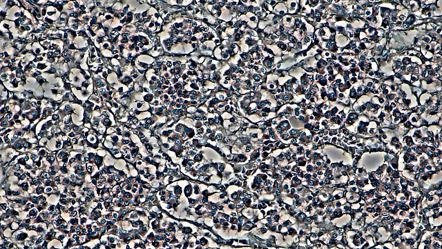Young Pineal Gland:  Hematoxylin and Eosin Staining