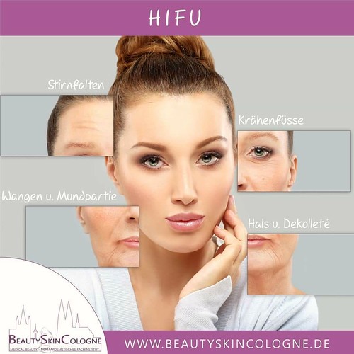 🌟 HIFU Lifting powered by Beauty Skin Cologne 🌟  Natürliche Schönheit ohne Skalpell und OP ⭐ Der Begriff HIFU oder Ultraschall Lifting ist auch unter dem Namen HIFU Lifting oder Ultherapy bekannt 🌟 Diese Methode verwendet hoch fokus | by beautyskincologne