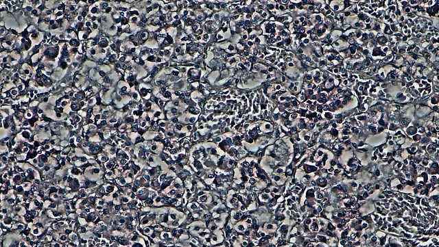 Young Pineal Gland:  Hematoxylin and Eosin Staining