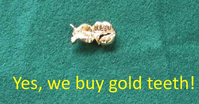 We buy Dental Gold