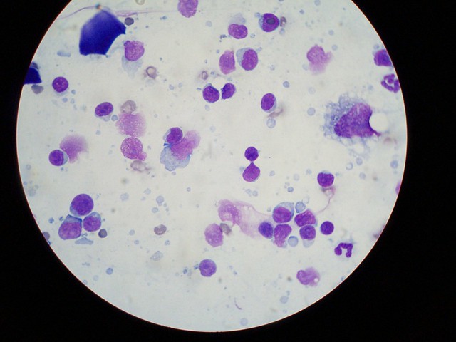lymph node aspirate from a 3-year old cat losing weight with swollen lymph nodes