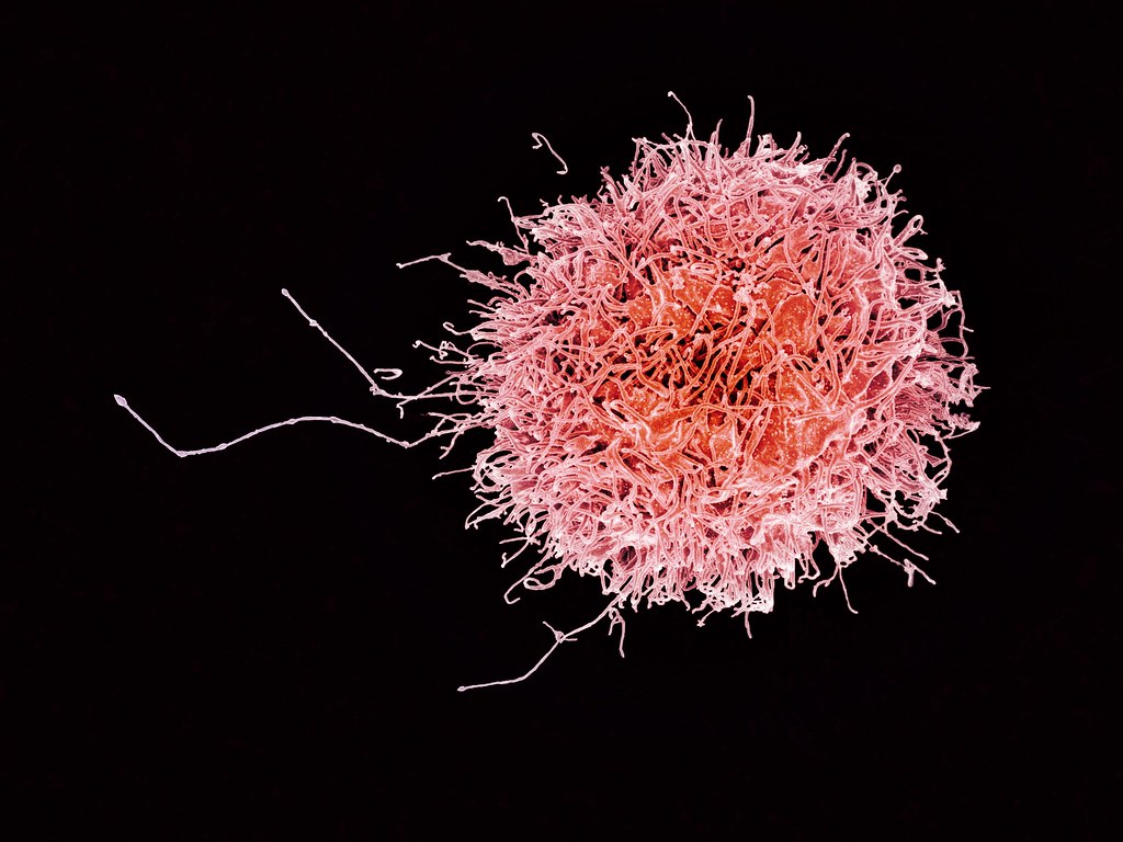Human Natural Killer Cell | Colorized scanning electron micr… | Flickr