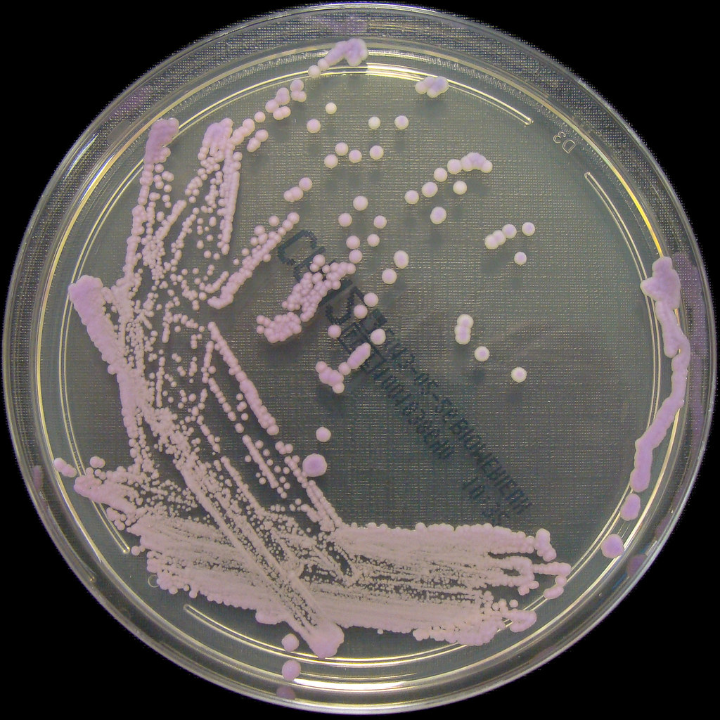 Candida tropicalis growing on ChromID Candida 2 Agar | Flickr