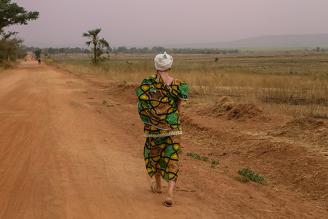 An Albino along the road near Banfora, Burkina Faso.