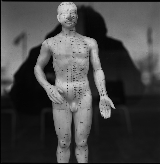 Acupuncture model in shop window