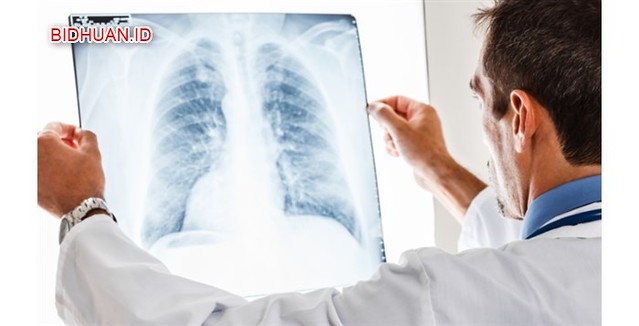 Tips Kesehatan - Gejala Paru-Paru Basah (Pneumonia): 20 Gejala Umum Dari Penyakit Paru-Paru Basah Lengkap