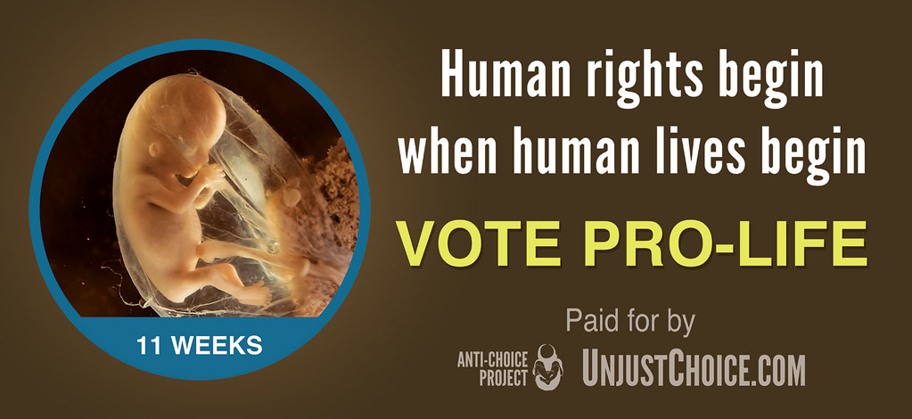 Anti-Choice Project Billboard - Human Rights