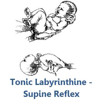 Image result for tonic labyrinthine reflex