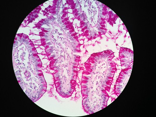 Human goblet cells | by Julian Gutierrez