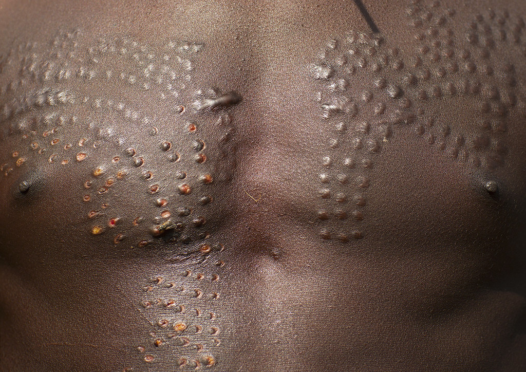 Suri man with scarification on the chest, Kibish, Ethiopia… | Flickr