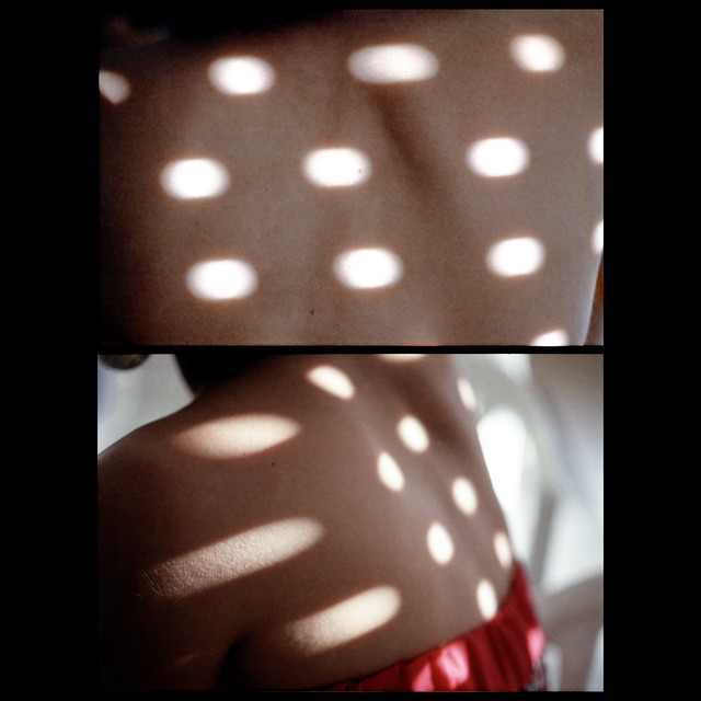 Skin and light spots