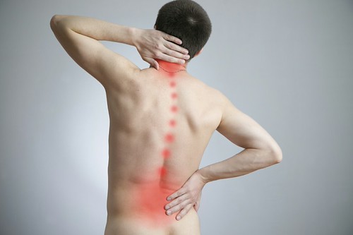Người bệnh có thể bị đau lưng nhiều do bong gân hoặc giãn dây chằng sau khi hoạt động mạnh, mang vác nặng. | by chuabenhkhoptambinh