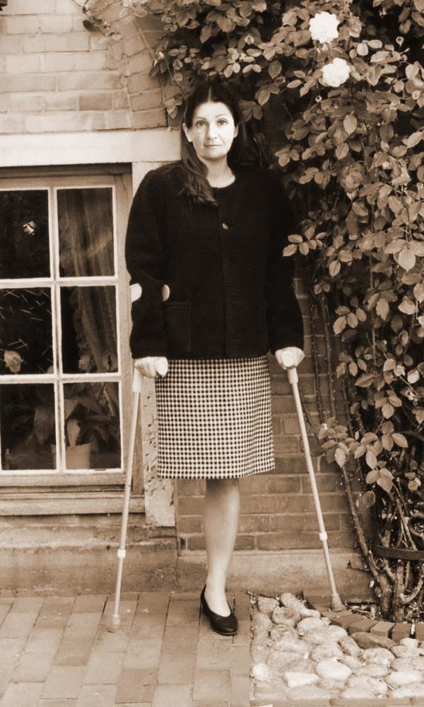 Jolanda Beautiful Woman Amputee Leg Crutches.