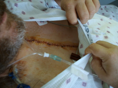 incision operation triplebypass mooreregionalhospitals