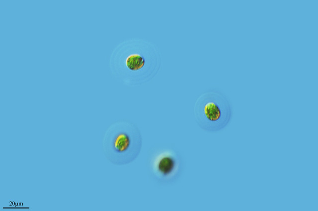 ATMÓSFERAS DE GELATINA EN ASTEROCOCCUS SUPERBUS | * * En Twi… | Flickr