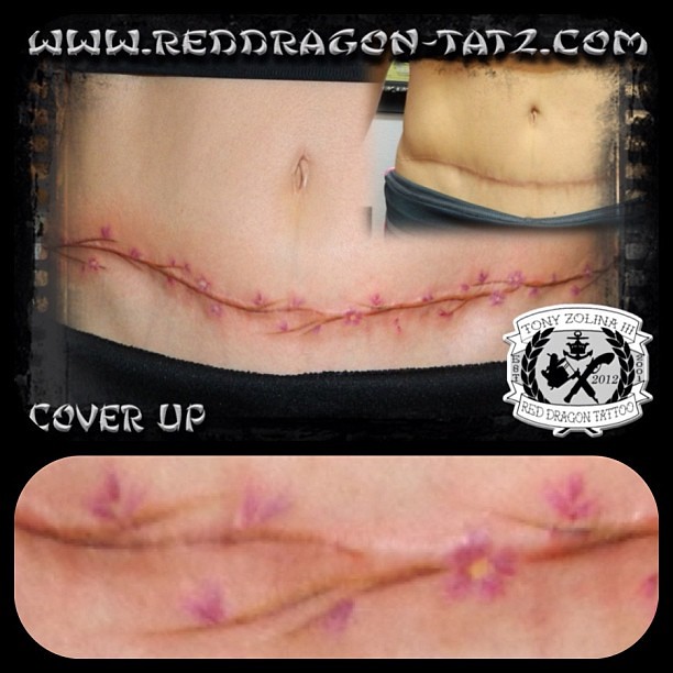 Crafty tummy tuck scar cover up with Cherry Blossom Branch…