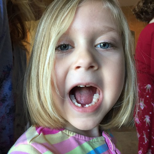 Lost Tooth | Ginger lost her first tooth (and her second one… | Flickr