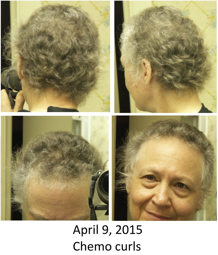 Hair Regrowth Continues 7: Chemo Curls Edition | I am a week… | Flickr