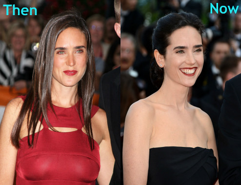 Jennifer Connelly Breast Reduction Before and After.