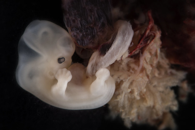Embryo at around 6  weeks EGA from conception