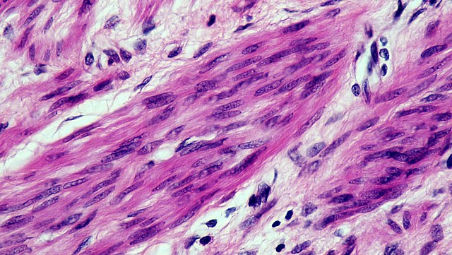 Muscle Tissue: Smooth