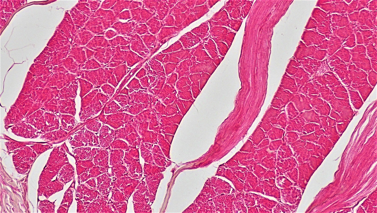 skeletal muscle cross section labeled