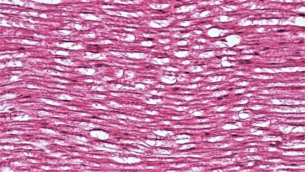 Nervous Tissue: Nerve Bundle | long section: nerve bundle ma… | Flickr