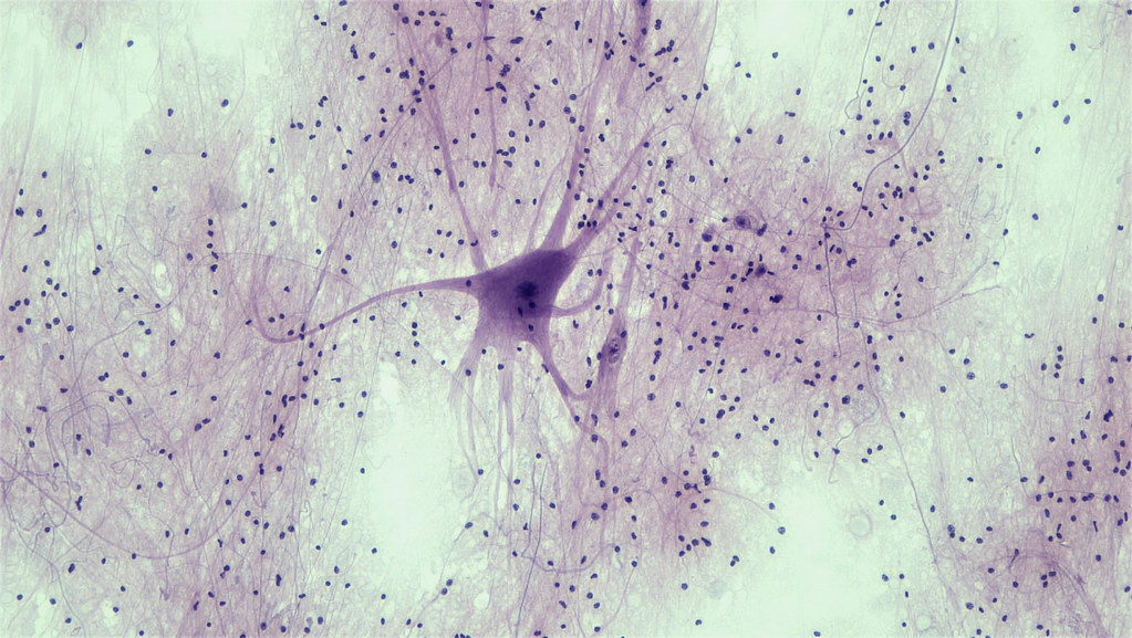 Nervous Tissue: Spinal Cord Motor Neuron | smear: spinal cor… | Flickr
